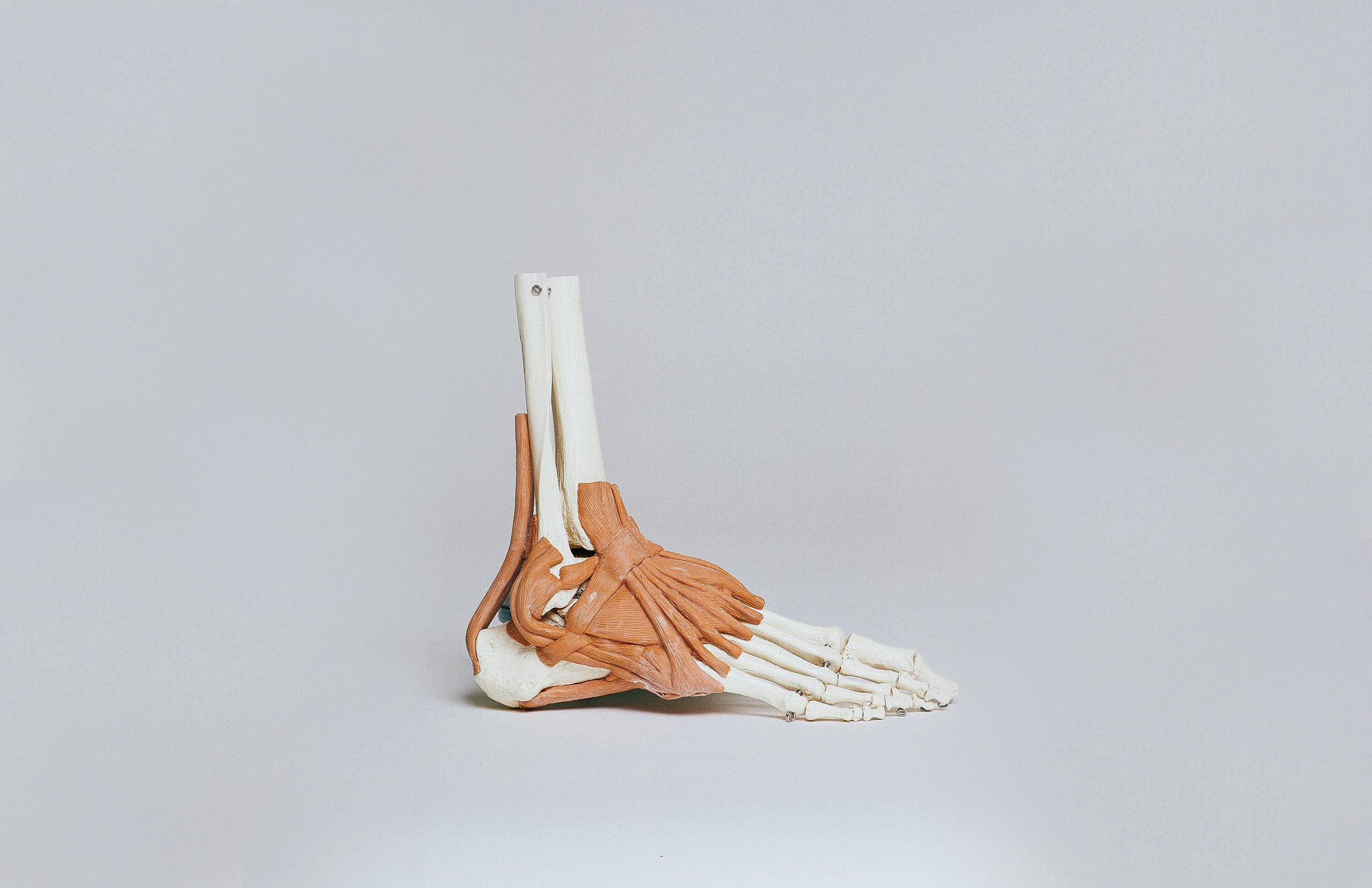 Tendinitis: cómo se desarrolla y se trata la inflamación del tendón
